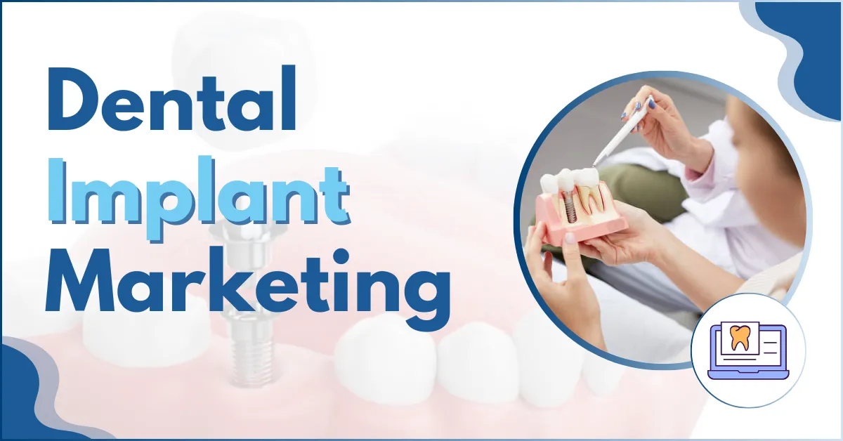 Dental Implant Marketing