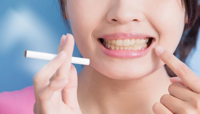 How Smoking Affects Your Oral Health