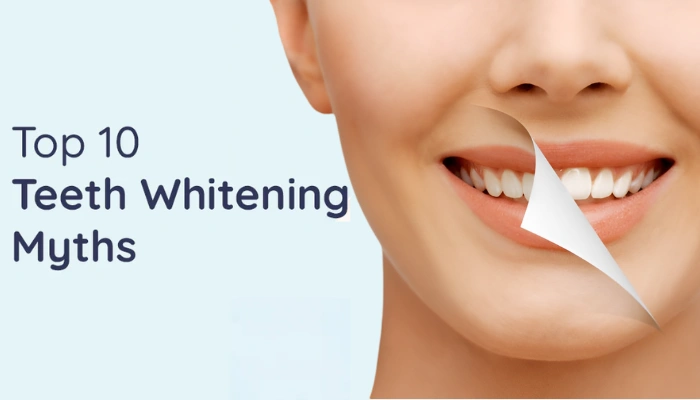 Top 10 Teeth Whitening Myths